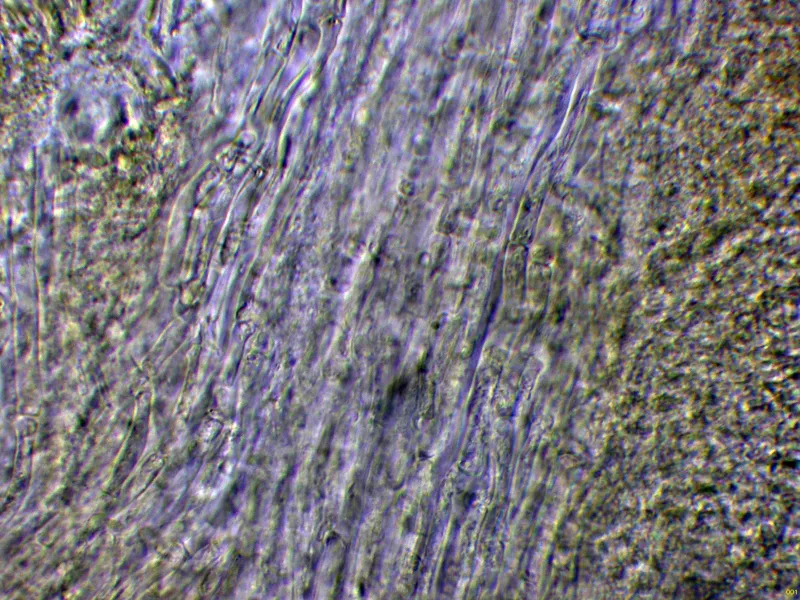 Ceriporiopsis subvermispora 10 - Hifas Melzer-001